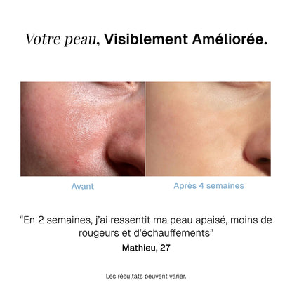 Masque anti-rougeurs au thé vert