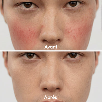 Masque Stick Anti-Rougeurs