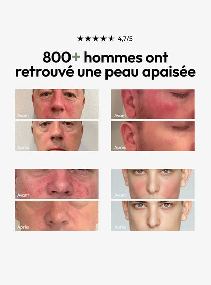 Masque Stick Anti-Rougeurs