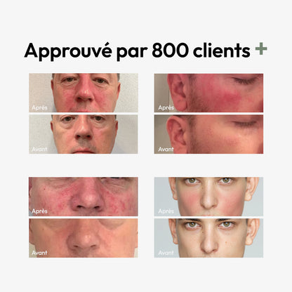 Masque Stick Anti-Rougeurs