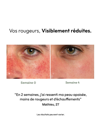 Masque Stick Anti-Rougeurs