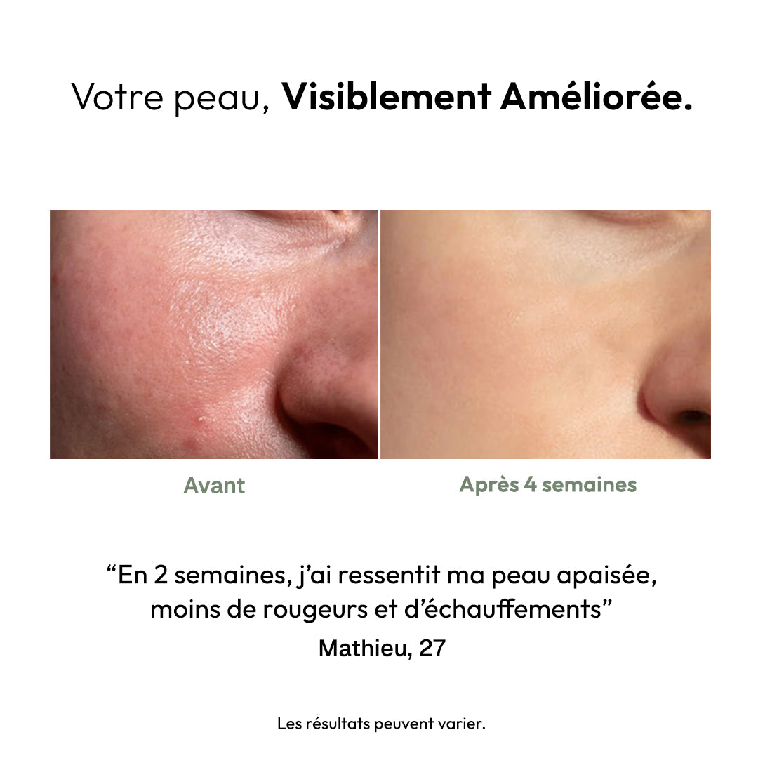 Masque Stick Anti-Rougeurs