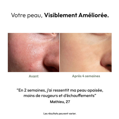 Masque Stick Anti-Rougeurs