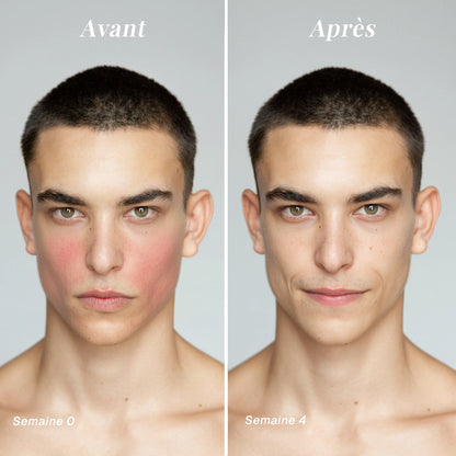 Masque anti-rougeurs au thé vert