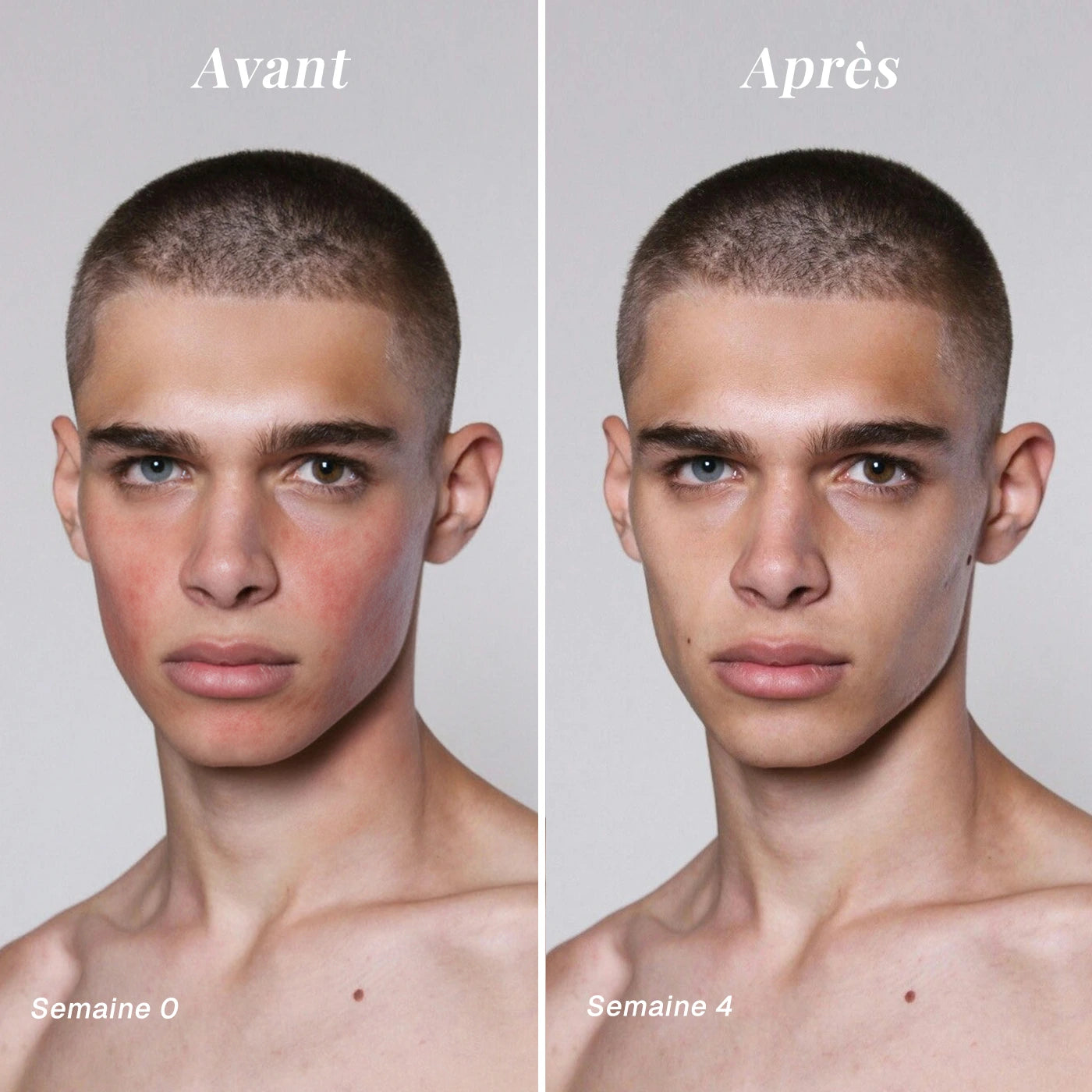 Masque anti-rougeurs au thé vert