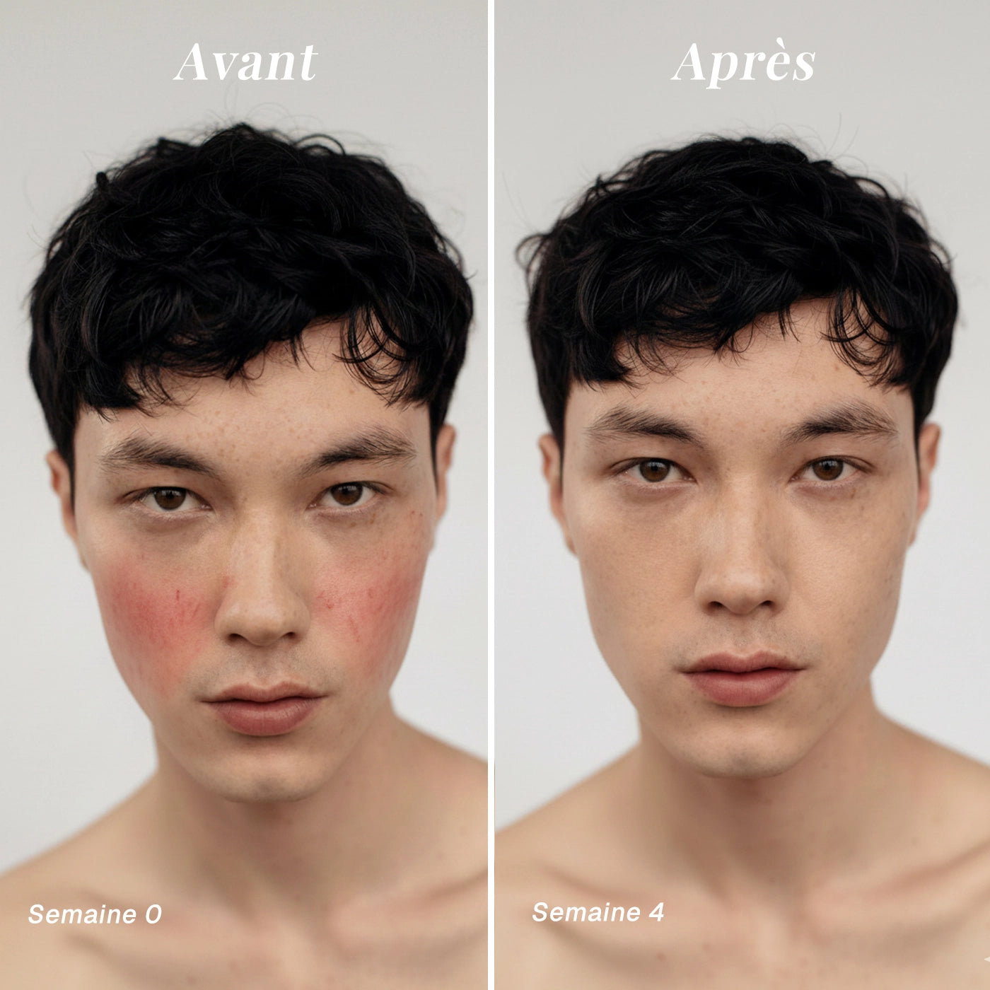 Masque anti-rougeurs au thé vert