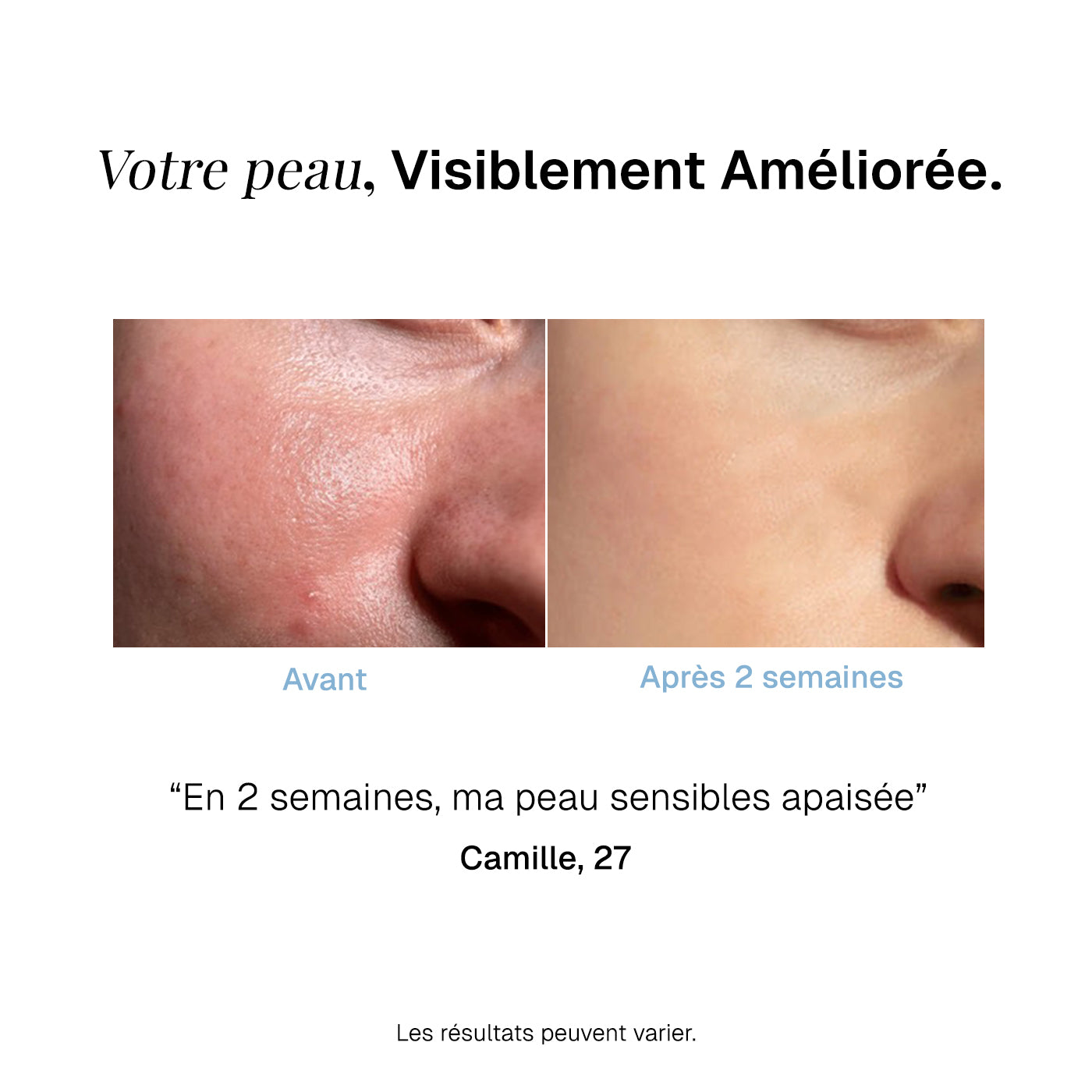 Masque stick Anti-Rougeurs au Thé Vert